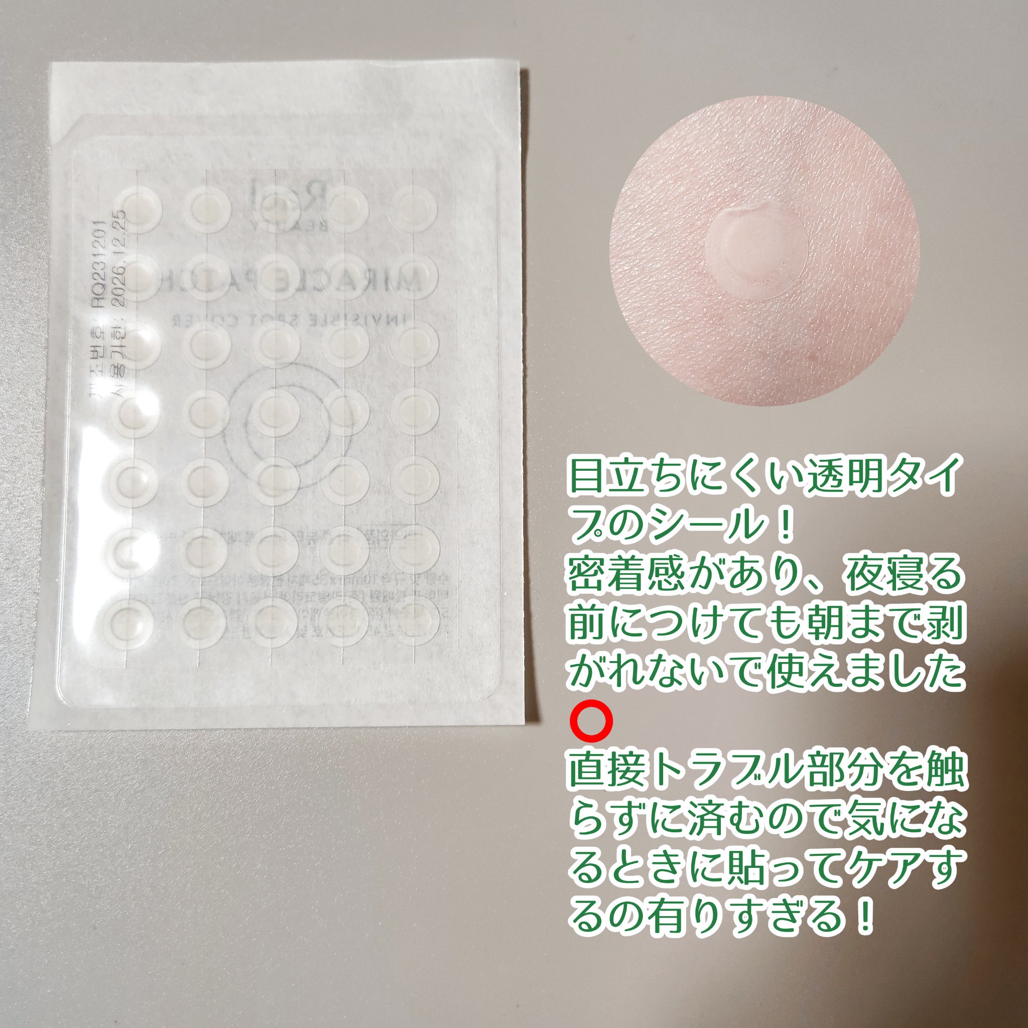 ビューティーミラクルパッチスポットカバー/Rael/にきびパッチを使ったクチコミ（2枚目）