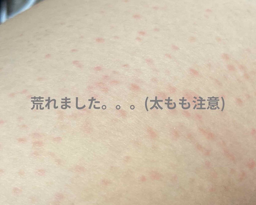 超熟睡®ショーツ/ソフィ/ナプキンを使ったクチコミ（2枚目）