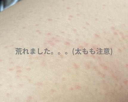 超熟睡®ショーツ/ソフィ/ナプキンを使ったクチコミ(2枚目)