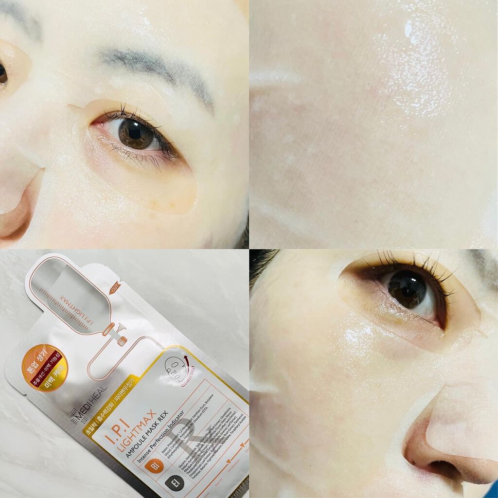 ビタライトビーム エッセンシャルマスク REX/MEDIHEAL/シートマスク・パックを使ったクチコミ(2枚目)