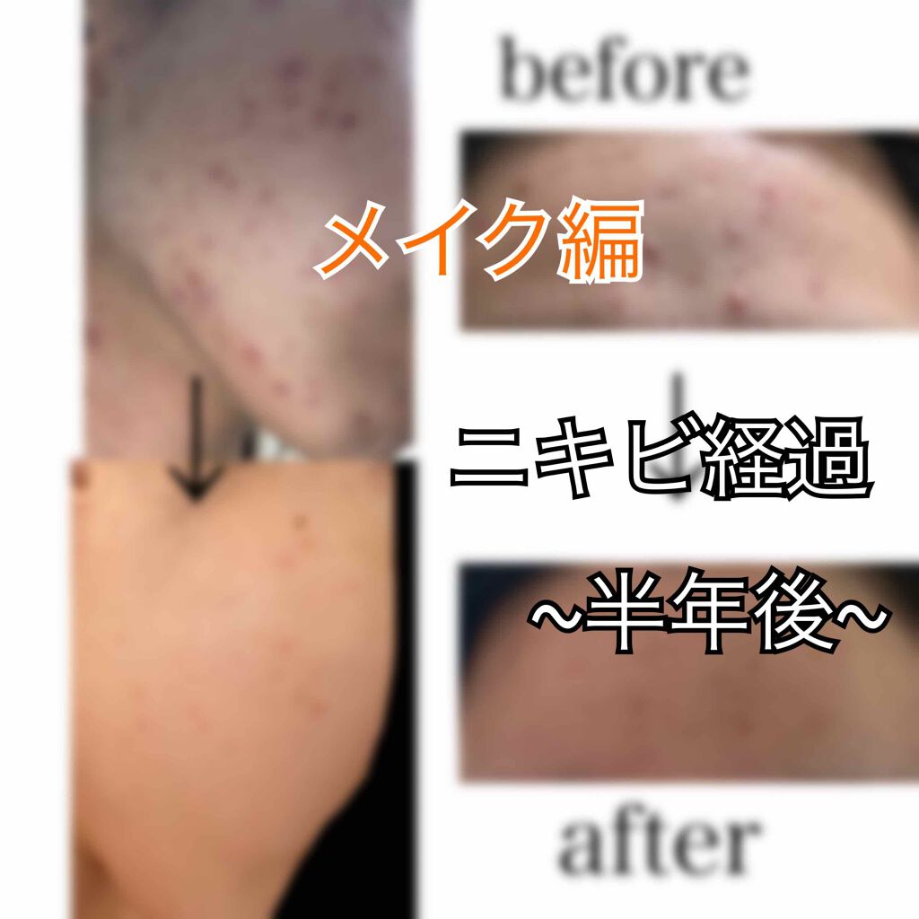 アレルバリア エッセンス/d プログラム/日焼け止め・UVケアを使ったクチコミ（1枚目）