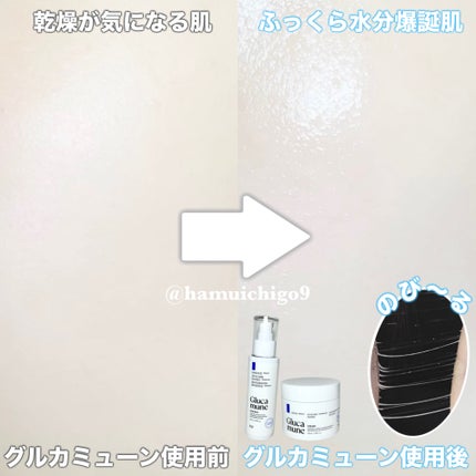 グルカミューンクリーム/VT/フェイスクリームを使ったクチコミ(3枚目)