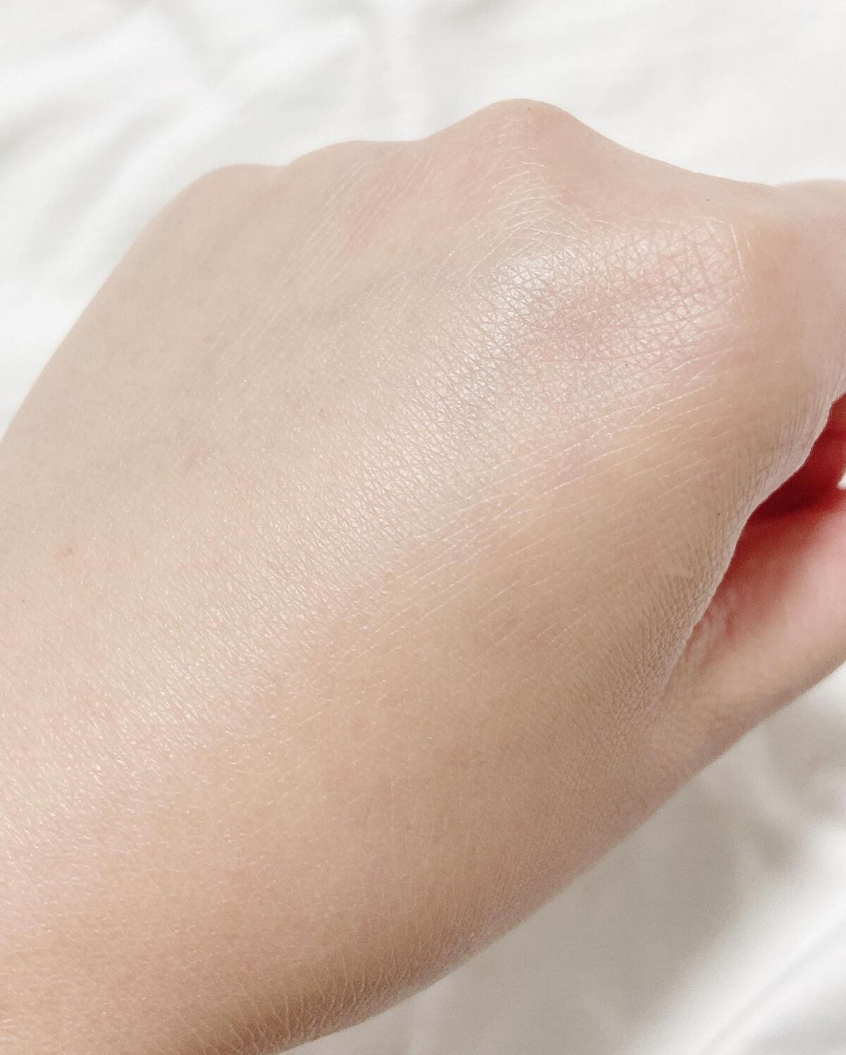 インテンシブセラム/Garlinu/美容液を使ったクチコミ(8枚目)