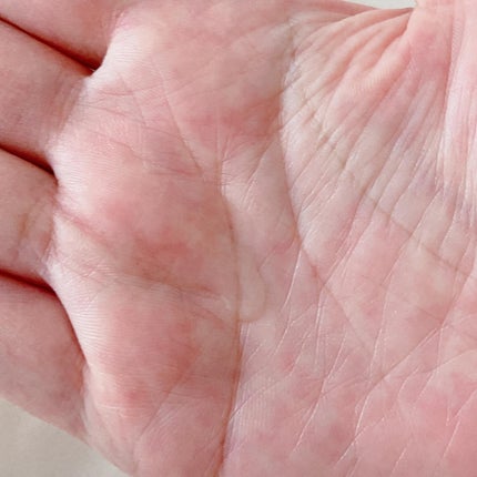 薬用 RJ地肌ケア エッセンス /アピセラピーコスメティクス/頭皮ローションを使ったクチコミ(4枚目)