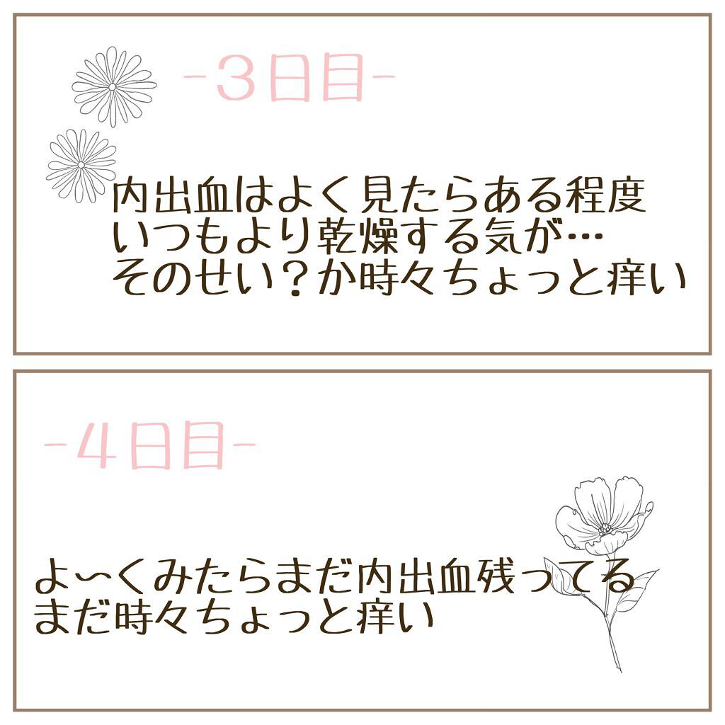 フェイシャル トリートメント エッセンス/SK-II/化粧水を使ったクチコミ(5枚目)