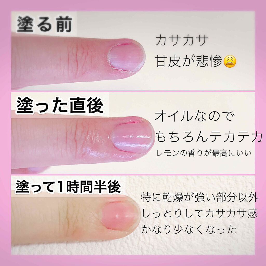 数々のアワードを受賞 キューティクルオイル 甘皮処理 Omd Gk10 ジャスミン 9ml ネイルオイル 爪 甘皮 美容液 割れ爪 二枚爪 ネイルケア ネイルサロン