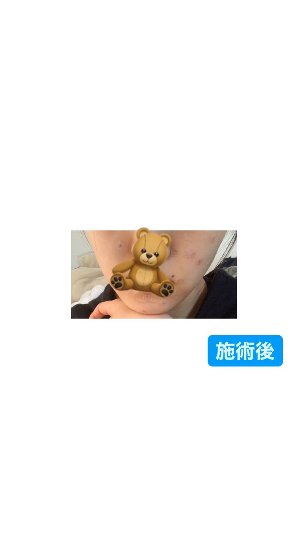 uâ on LIPS ãð±.æ·»ä»åçã§ãããé¡ã®ããŒããé ããããã«ãªãã¹ãå°ãããã..ãïŒ3æç®ïŒ