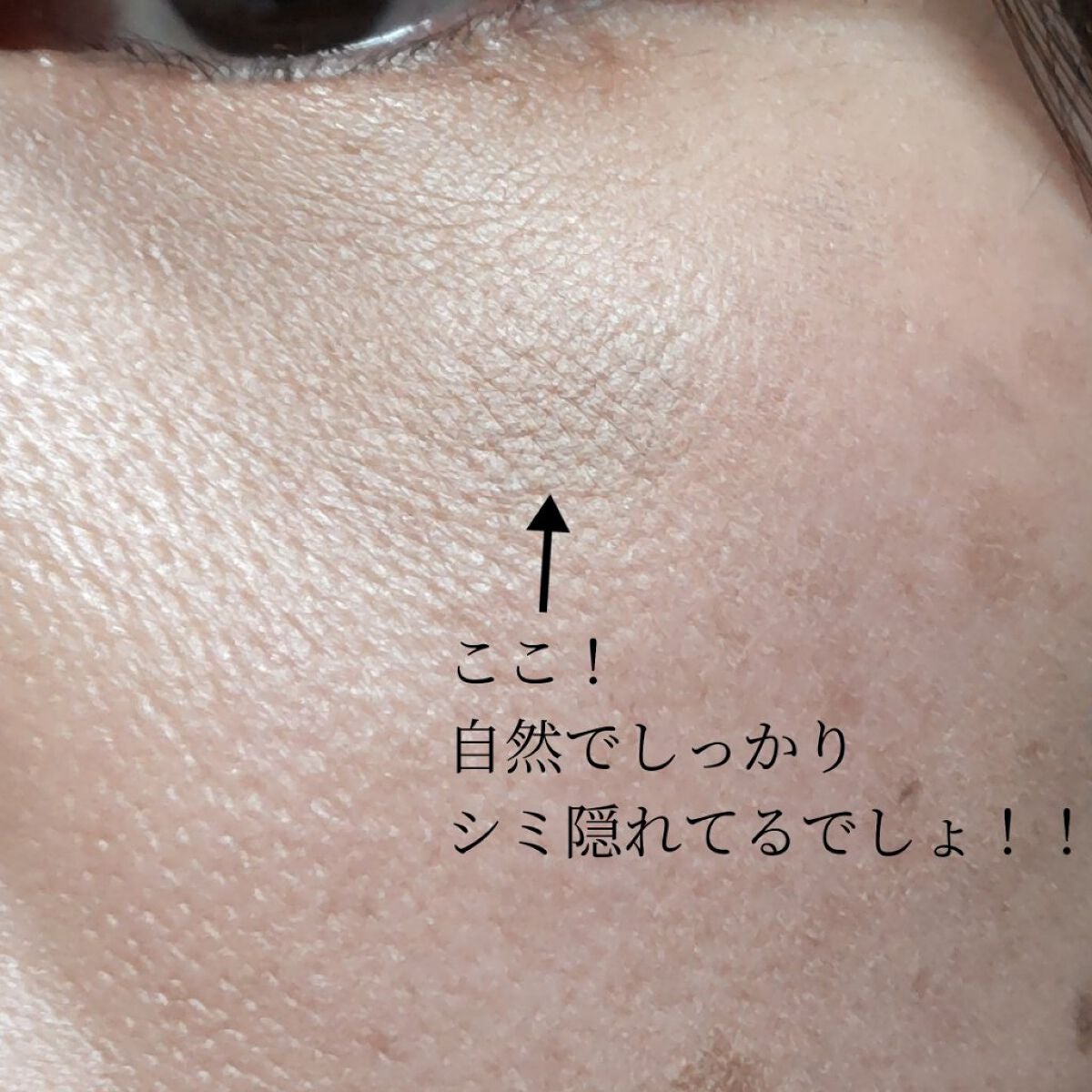 ソフトマットコンプリートコンシーラー/NARS/クリームコンシーラーを使ったクチコミ(3枚目)