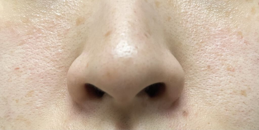 シカフルアンプル/beplain/美容液を使ったクチコミ（3枚目）