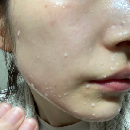 フェイシャルマイルドピーリング/primera/ピーリングを使ったクチコミ(4枚目)