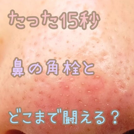 オルビスユー ジュレパック/オルビス/洗い流すパック・マスクを使ったクチコミ(1枚目)