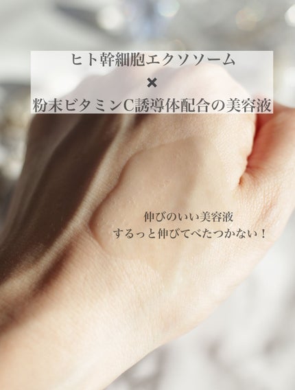 haruka on LIPS 「マスクで口元が気になってないですか??長引くマスクで、口元の乾..」(4枚目)