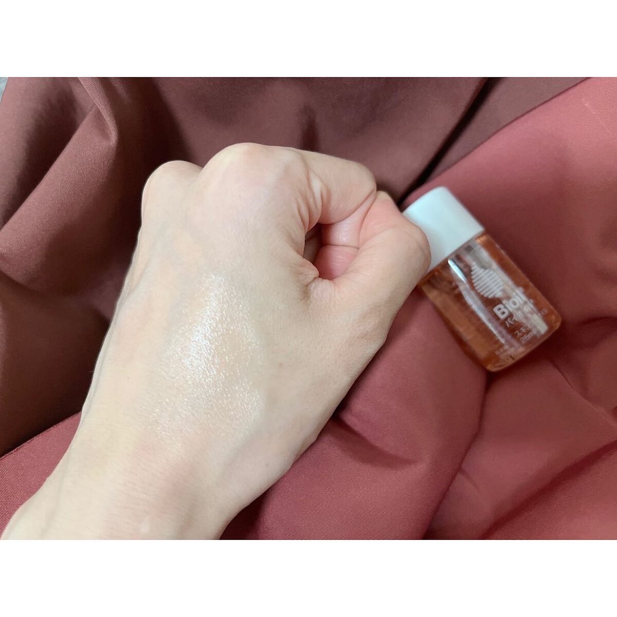 バイオイル/バイオイル/フェイスオイルを使ったクチコミ（2枚目）