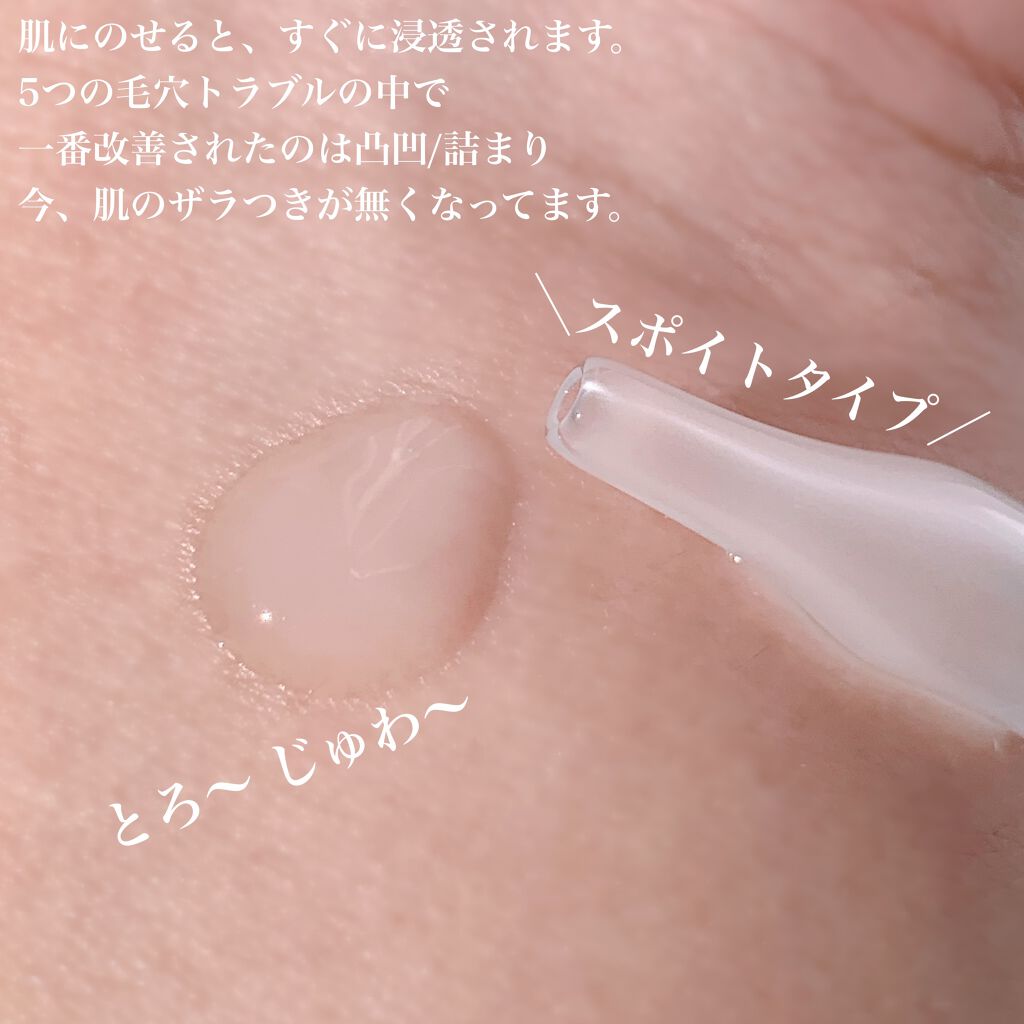 セラムショット N/PHOEBE BEAUTY UP/美容液を使ったクチコミ(2枚目)