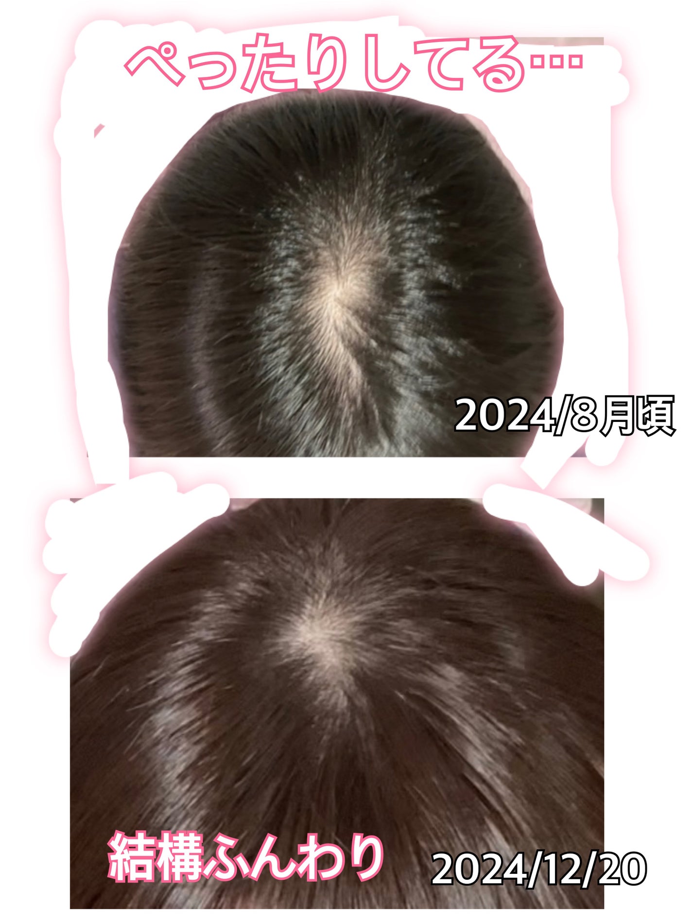 薬用 メディカル アンチヘアロスセラム/L'OCCITANE/頭皮ローションを使ったクチコミ(3枚目)