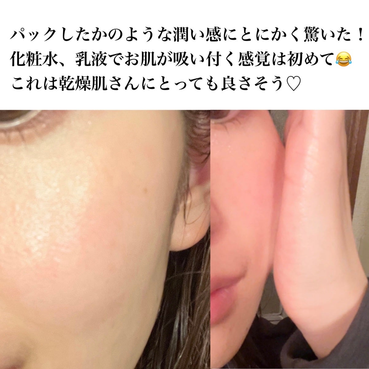 モイストケア ローション MB/d プログラム/化粧水を使ったクチコミ(5枚目)