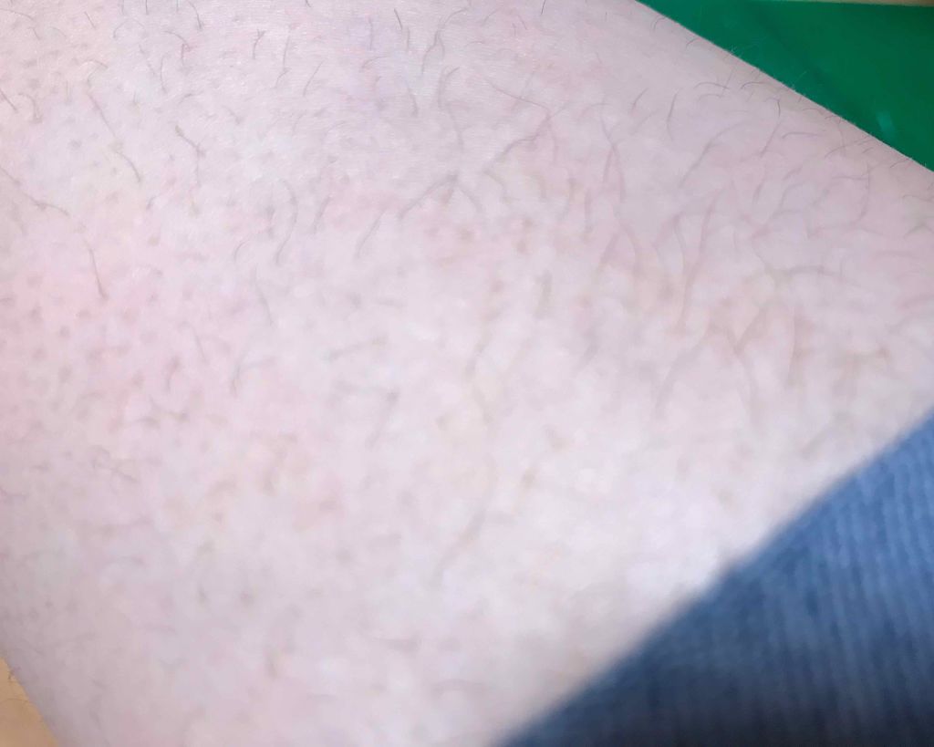 スムーズスキン/DAISO/ムダ毛ケアを使ったクチコミ（1枚目）