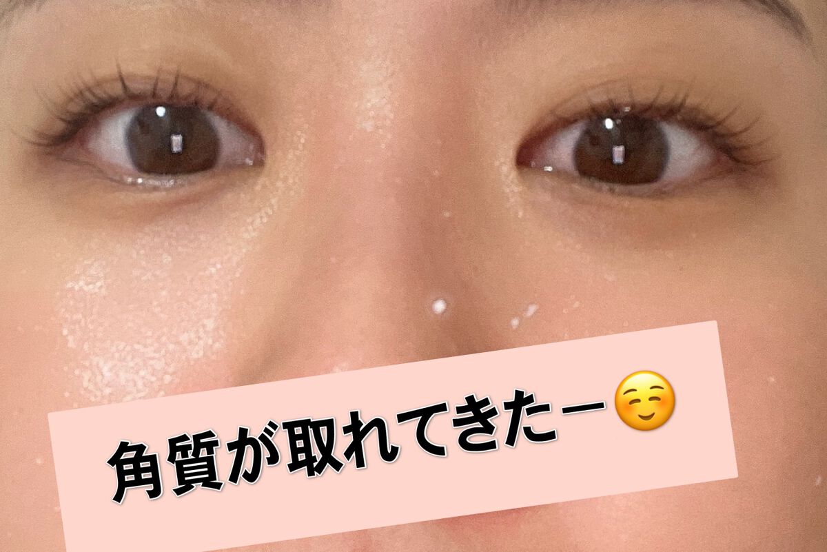 フェイシャルマイルドピーリング/primera/ピーリングを使ったクチコミ(3枚目)