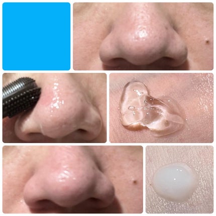 チョコブラ スペシャル毛穴ケアセット/Chocobra/スキンケアキットを使ったクチコミ(2枚目)