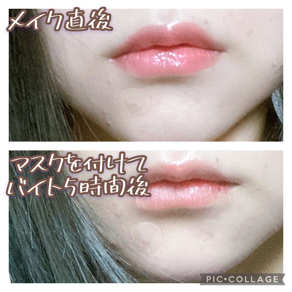 クリアパッチ/Angelab/にきびパッチを使ったクチコミ(5枚目)