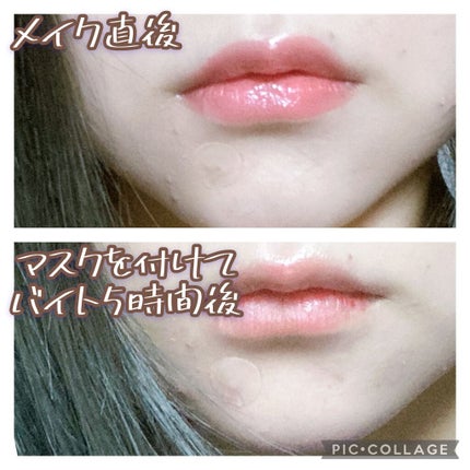 クリアパッチ/Angelab/にきびパッチを使ったクチコミ(5枚目)