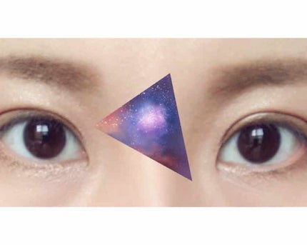 りっちゃん on LIPS 「【!!閲覧注意!!】去年の夏に二重整形(全切開)を高須クリニッ..」(4枚目)