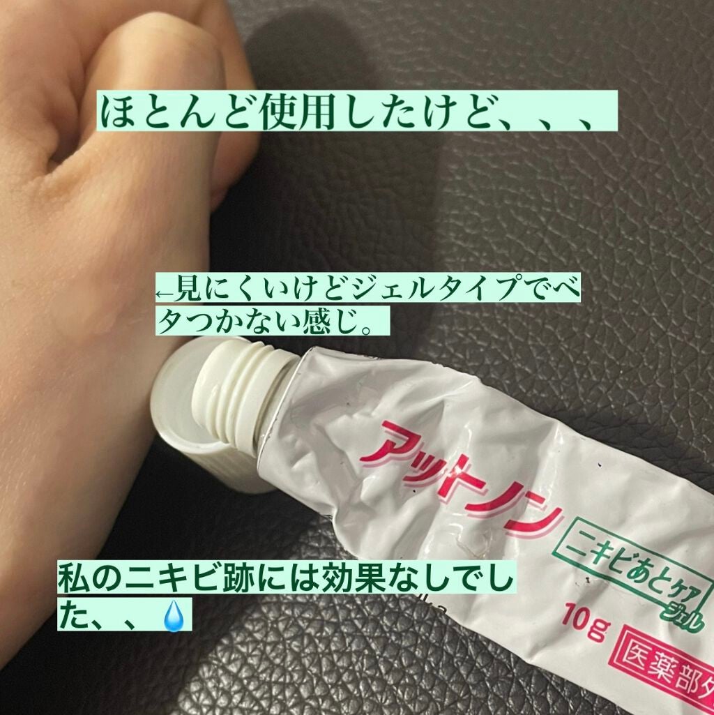 ニキビあとケアジェル/アットノン/その他スキンケアを使ったクチコミ(2枚目)