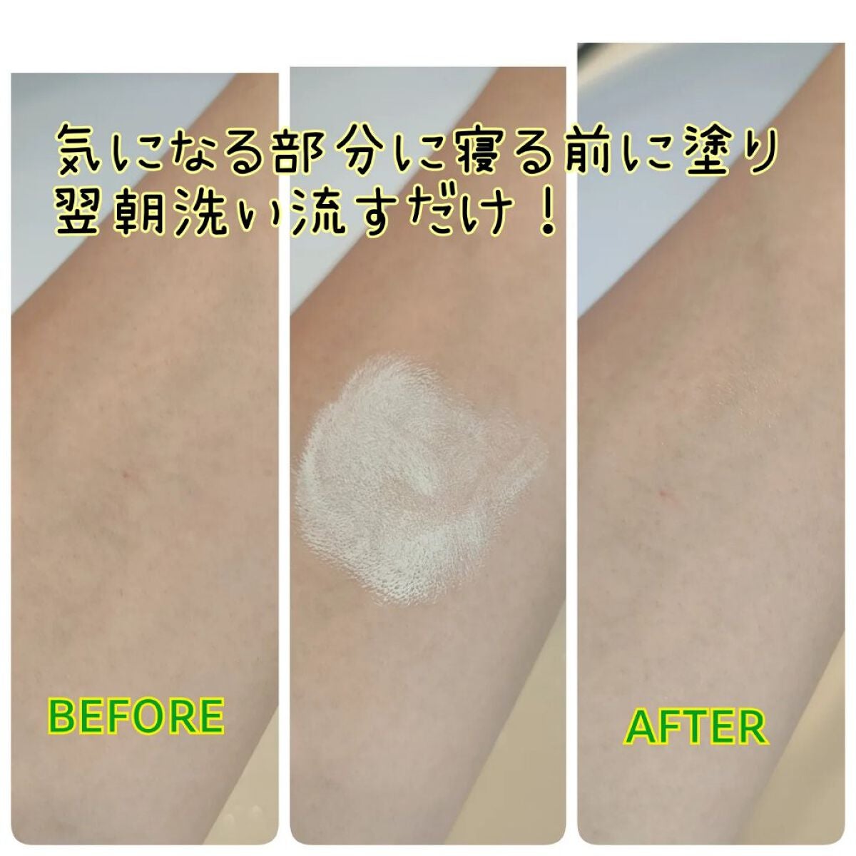 ミラクルアクネクリアスポットトリートメント/SOME BY MI/美容液を使ったクチコミ(2枚目)