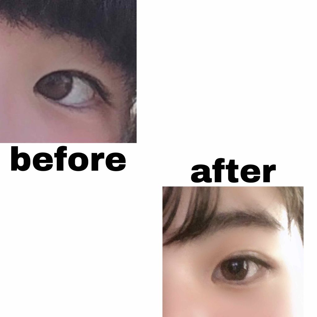 【旧品】オリシキ アイリッドスキンフィルム/D-UP/二重まぶた用アイテムを使ったクチコミ(1枚目)