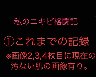 こんにちは(*^^*)

小梅です。ニキビと戦うこと約5年になります。
今までは見る専でしたが、自分の日記をつけたくなり、また少しでも同じ悩みの人と共有したいな、と思い、LIPSでは私のニキビ格闘記を記