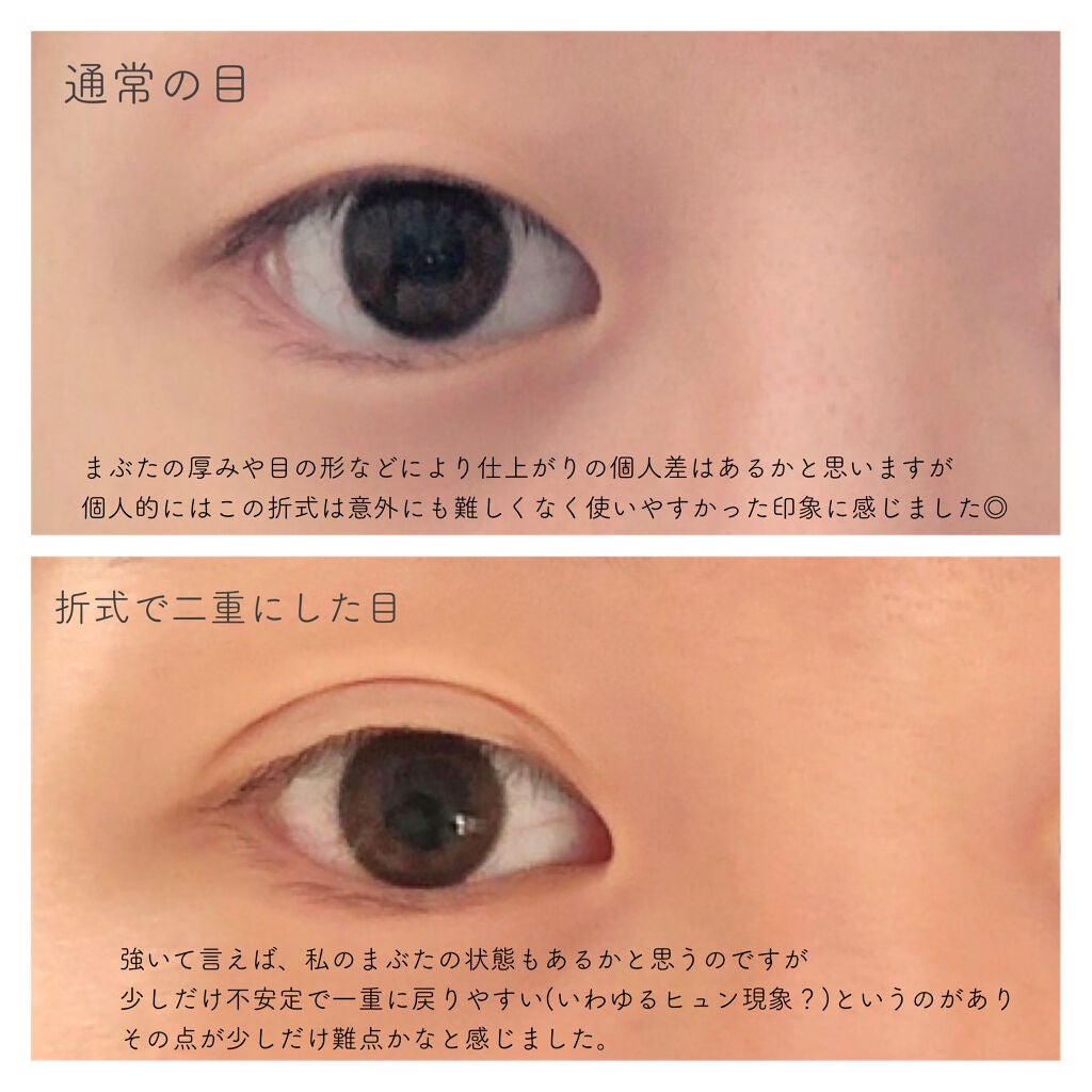 オリシキ アイリッドスキンフィルム /D-UP/二重まぶた用アイテムを使ったクチコミ(6枚目)