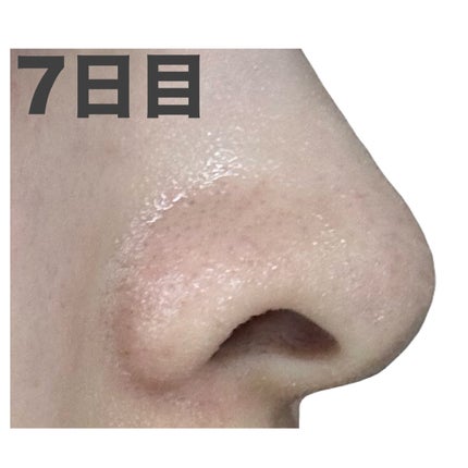 スキンコンディショナー高保湿/CEZANNE/化粧水を使ったクチコミ(10枚目)