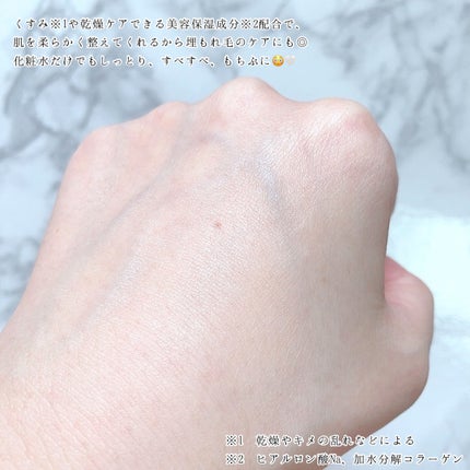 VIO TREATMENT LOTION/iroha INTIMATE CARE/デリケートゾーンケアを使ったクチコミ(5枚目)