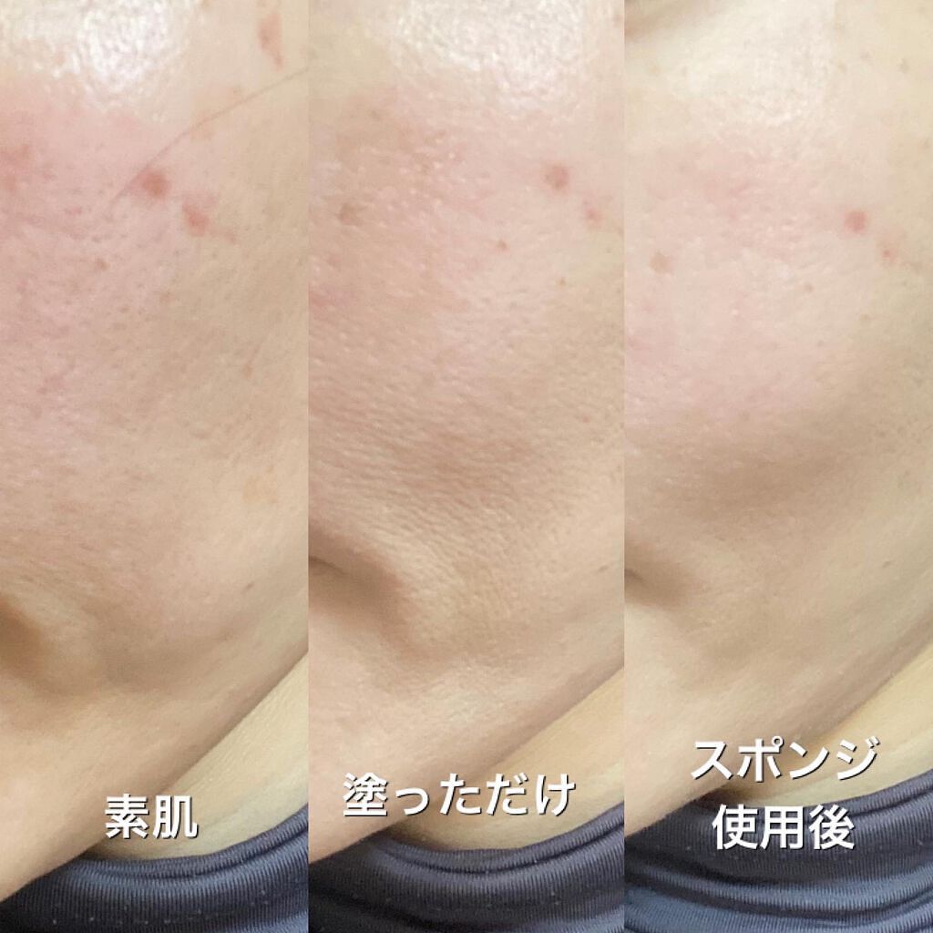 Wエッセンス/shimaboshi/美容液を使ったクチコミ（3枚目）