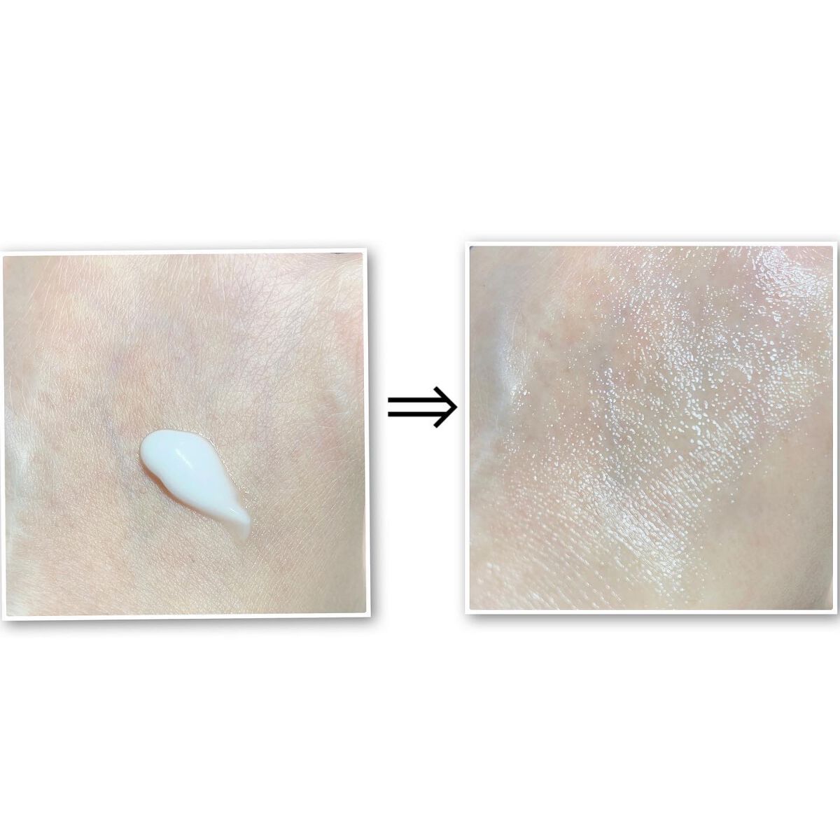 アンダーポアフォームクレンザー/P.CALM/洗顔フォームを使ったクチコミ(7枚目)