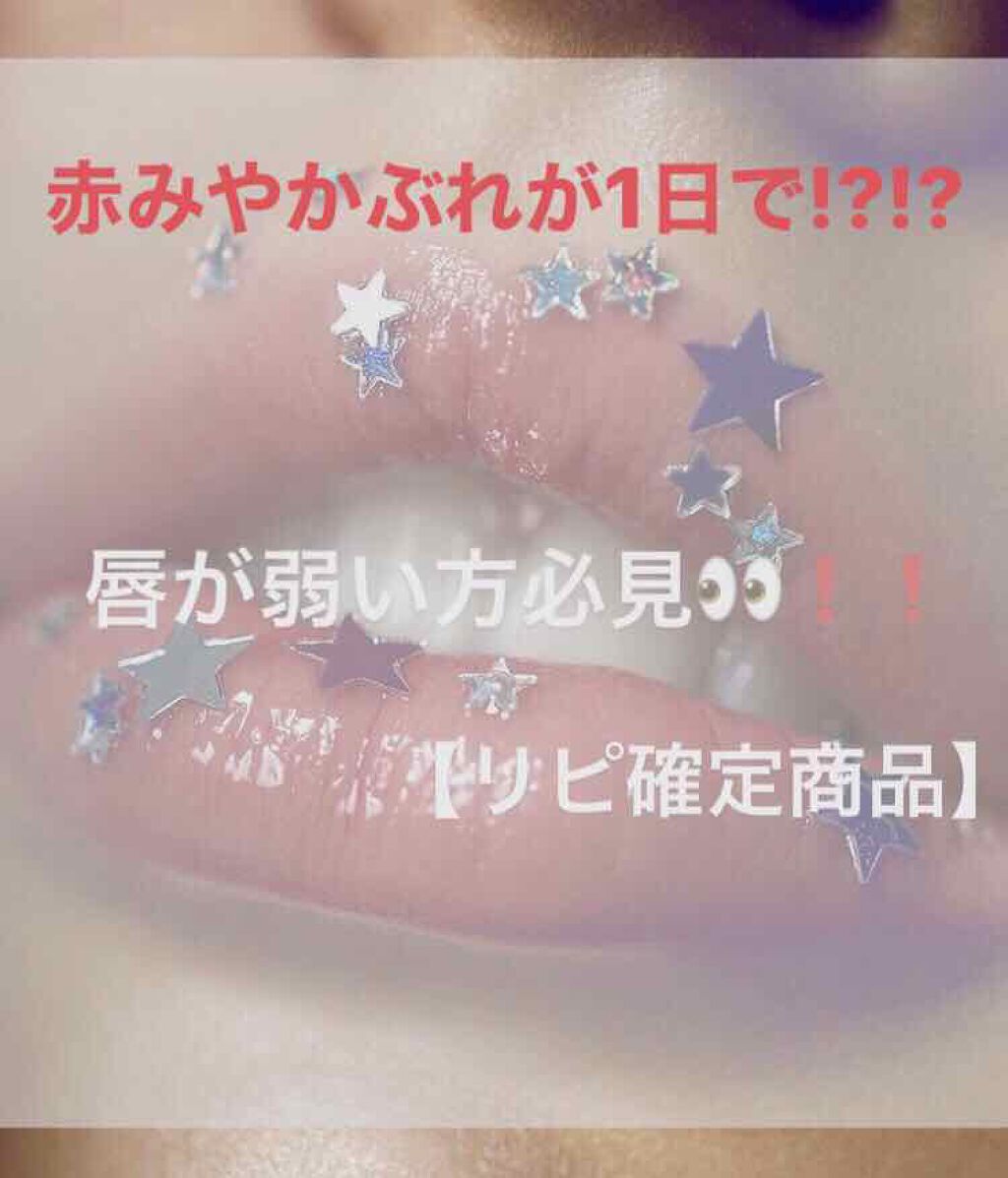 モアリップ N (医薬品)/資生堂薬品/その他を使ったクチコミ（1枚目）