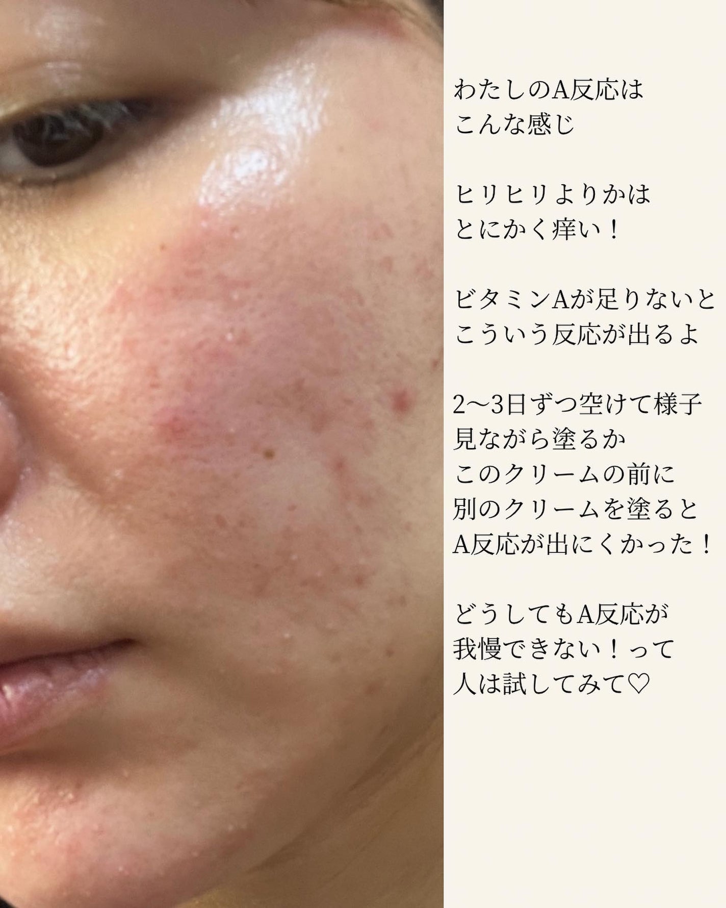 ビタミンA-mazingバクチオールナイトクリーム/By Wishtrend/フェイスクリームを使ったクチコミ(5枚目)