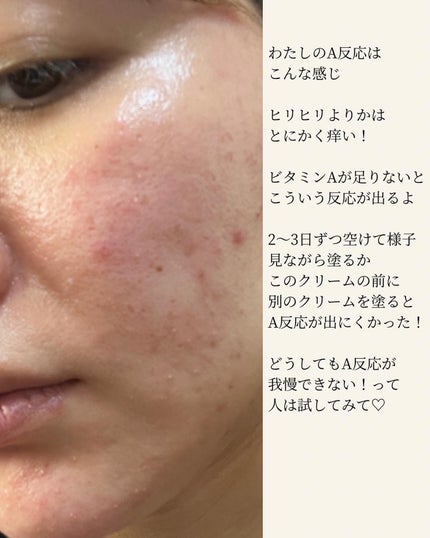 ビタミンA-mazingバクチオールナイトクリーム/By Wishtrend/フェイスクリームを使ったクチコミ(5枚目)