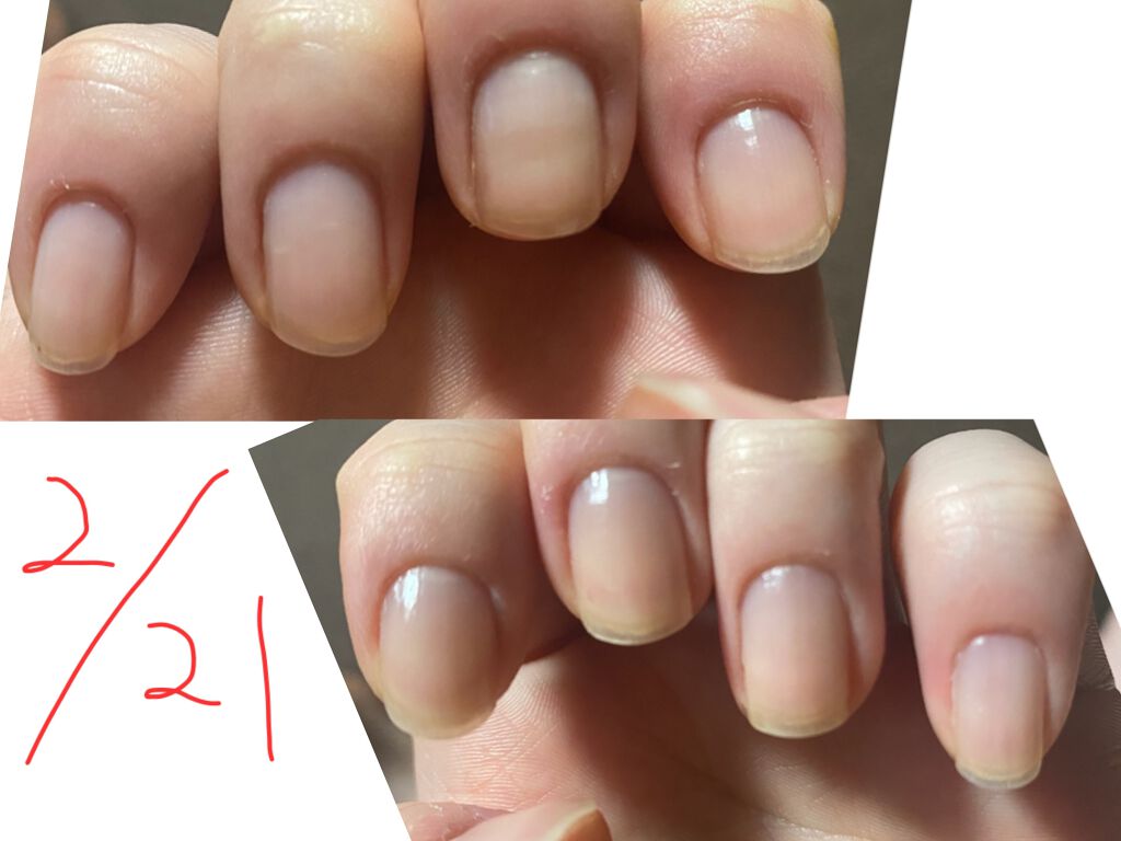 ネイルエンビー/O・P・I/ネイルオイル・トリートメントを使ったクチコミ（2枚目）