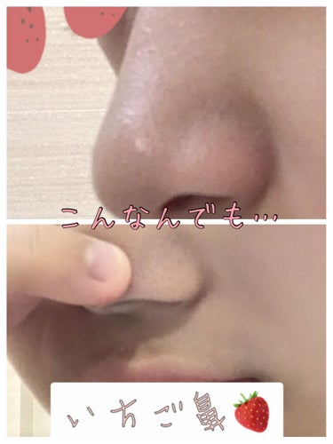 초코우유  on LIPS 「こんにちは！(¨̮)/초코우유です！今回は、いちご鼻に悩んでる..」（2枚目）