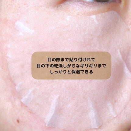 センテラ クイックカーミングパッド/SKIN1004/トナーパッドを使ったクチコミ(7枚目)