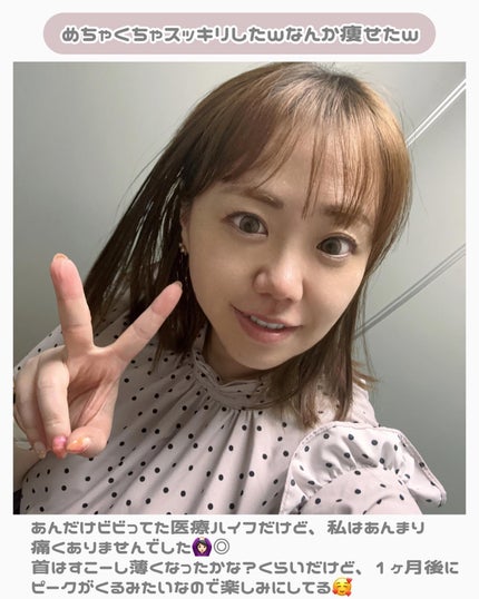 ちっちみ on LIPS 「👈他にも美容情報投稿してます💜𓂃𓈒𓏸𑁍𑁍𓏸𓈒𓂃\首周り..」(4枚目)