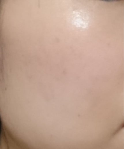 フォーエバー リブレイター Yセラム N/YVES SAINT LAURENT BEAUTE/美容液を使ったクチコミ(2枚目)