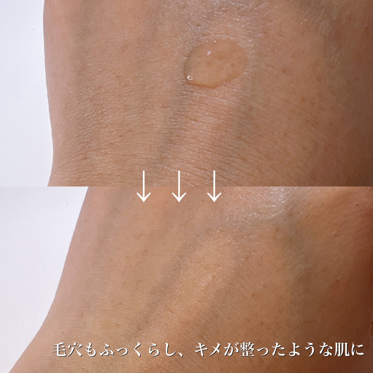 ルミエール ヴァイタルC/FEMMUE/ブースター・導入液を使ったクチコミ(3枚目)