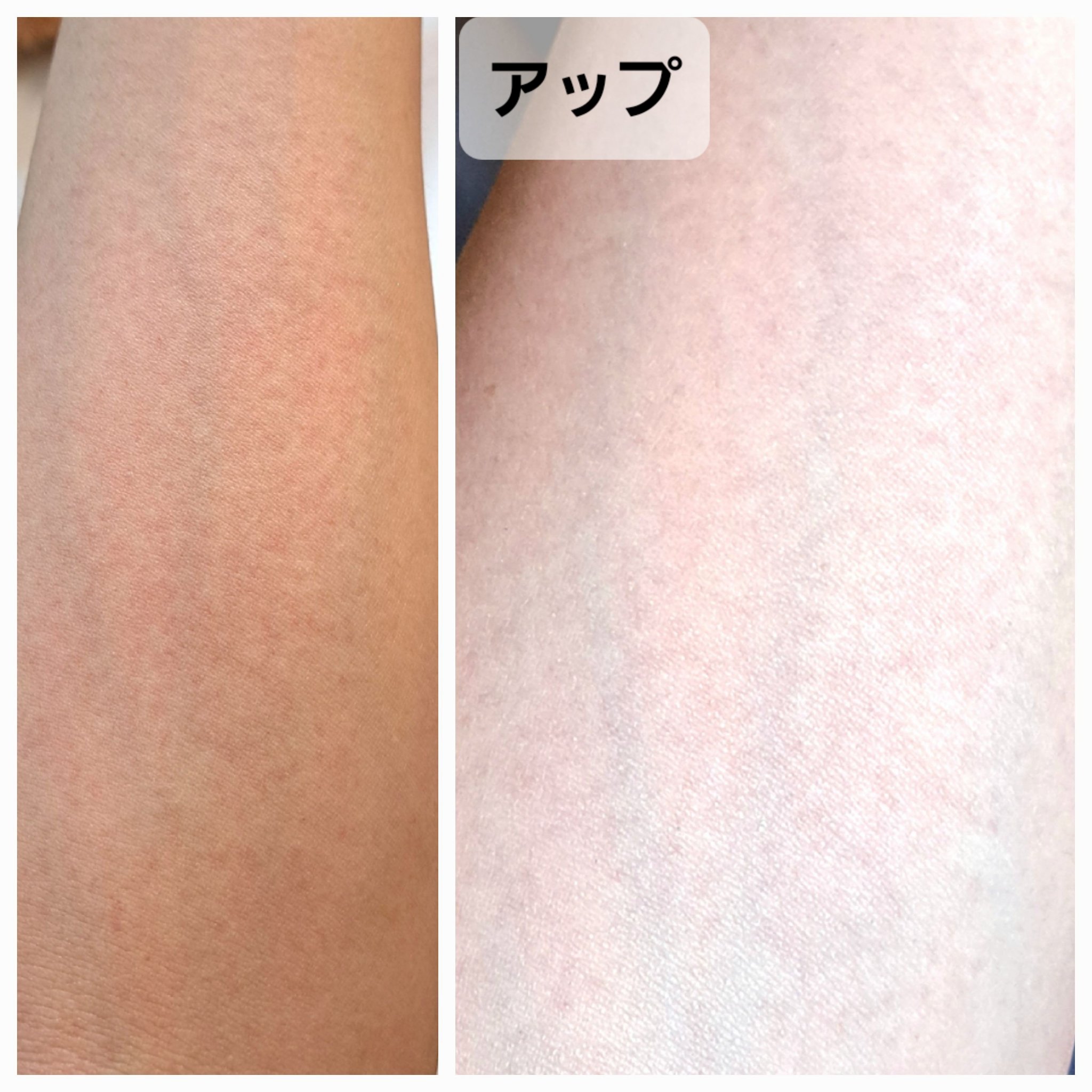 リードルショット100/VT/美容液を使ったクチコミ（2枚目）