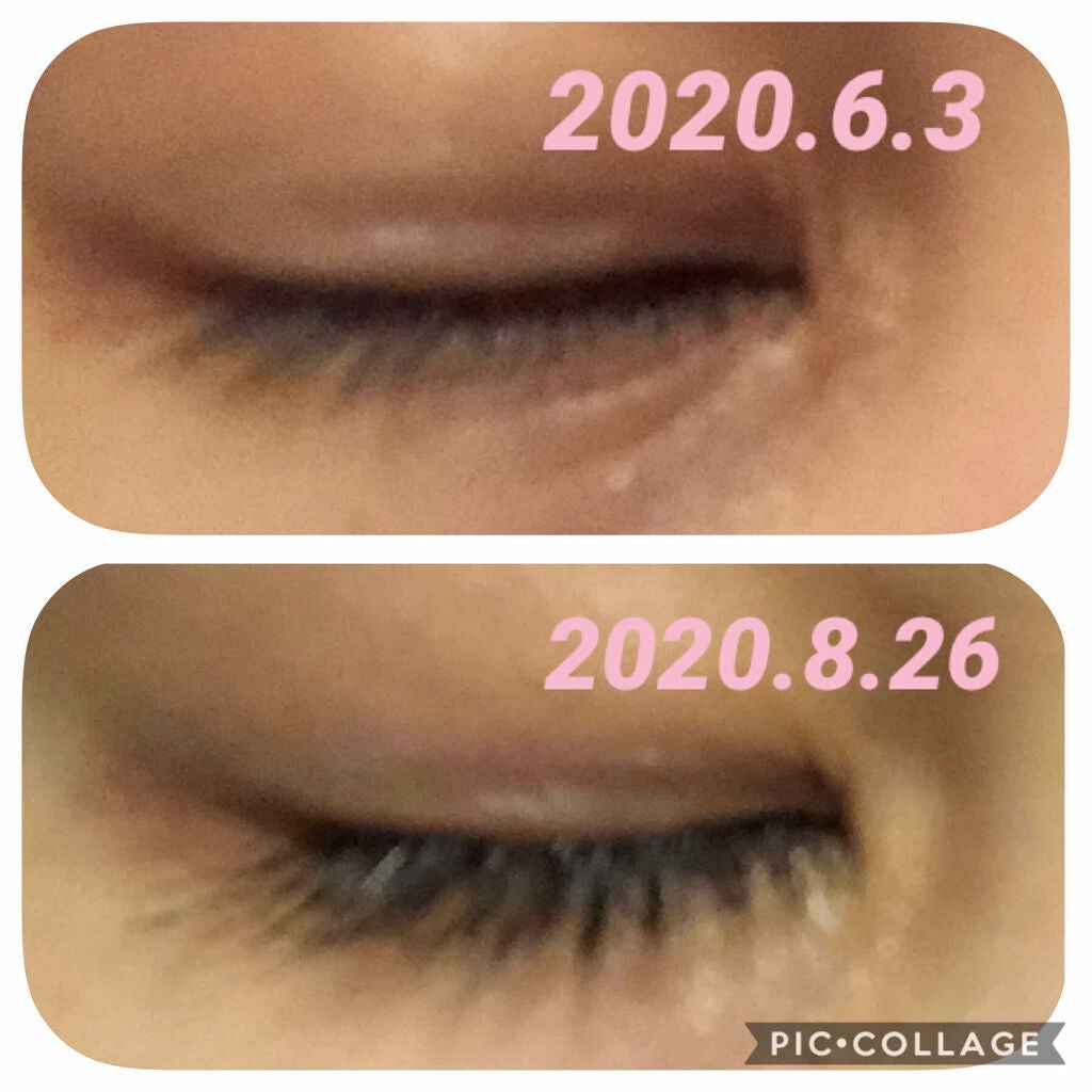 EMAKED(エマーキット)/水橋保寿堂製薬/まつげ美容液を使ったクチコミ(2枚目)