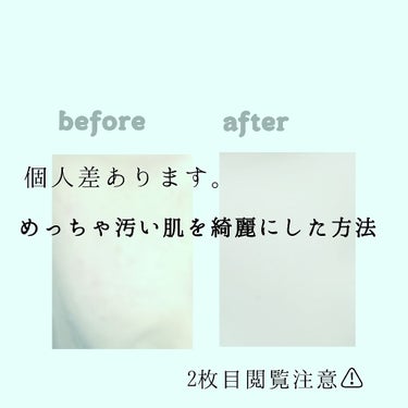 肌ケア

こんにちは!!ちろるです!!

今回は好きな人を落とす方法を紹介するはずだったんですが
ごめんなさい🙏間違えました🙏
ので今回は肌を綺麗にした方法を紹介させてください🙇

では!!気を取り直し