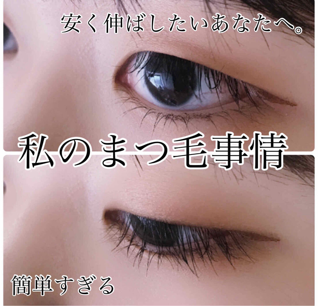 ローヤルゼリー配合 栄養ローション/DAISO/美容液を使ったクチコミ（1枚目）