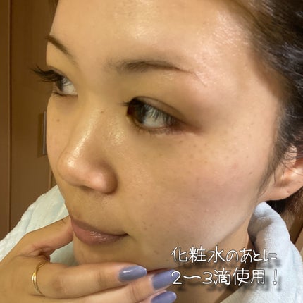 ピールケアオイル/chant a charm /ピーリングを使ったクチコミ(4枚目)