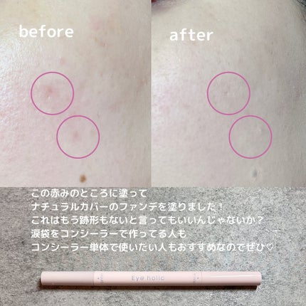 ããð(æçš¿ããæ¹ãã©ãã100ð©·) on LIPS ã...Eyeholicã³ã³ã·ãŒã©ãŒãã³ã·ã«ãã³ã¯ããŒãžã¥Â¥1,..ãïŒ5æç®ïŒ